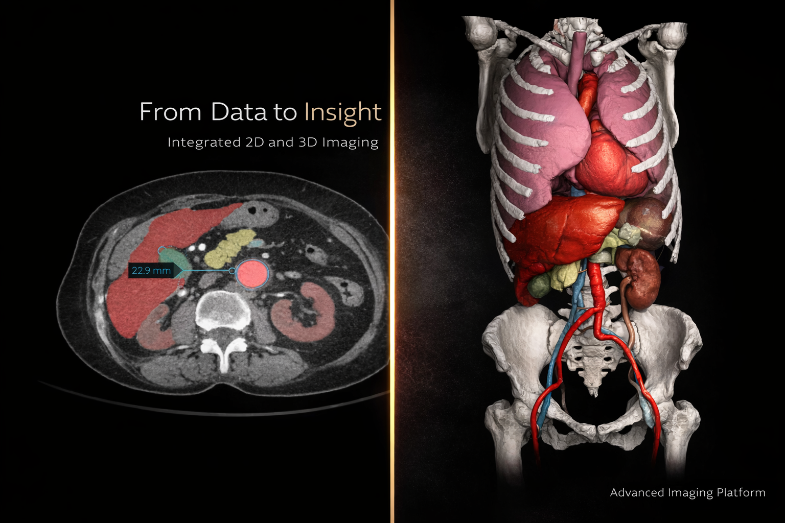 DICOM Vision 3D volume rendering of medical imaging data – CT and MRI visualization